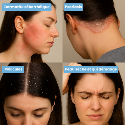 Crème Nusevia | Peau & cuir chevelu apaisés
