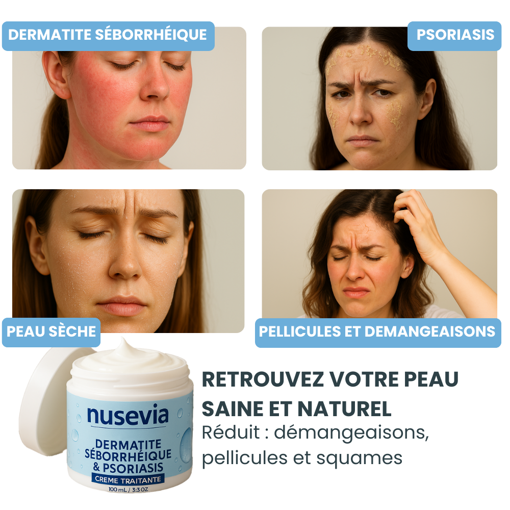 Crème Nusevia | Peau & cuir chevelu apaisés